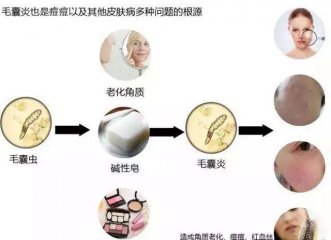 ë���׷�����Ӧ���������